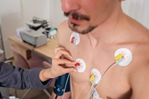 Mastering EKG Practice Strips: From Basics to Brilliance